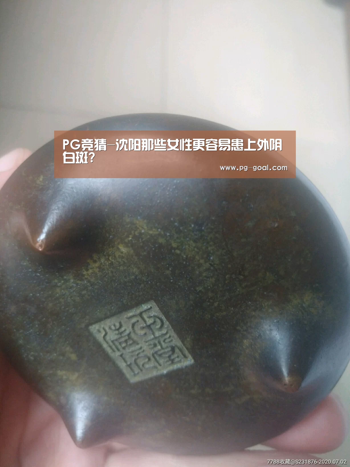 PG竞猜-沈阳那些女性更容易患上外阴白斑?(图3) PG足球
